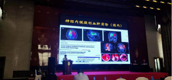 【AG旗舰厅医疗】热烈庆祝中国神经内镜微创治疗高血压脑出血技术推广会顺利召开